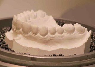 schonende Zahnregulierung