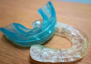 sanfte Zahnregulierung