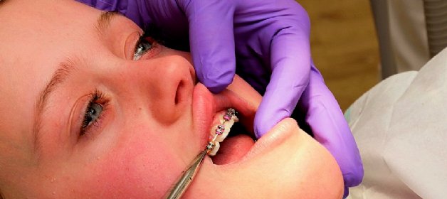 alternative Methoden der Zahnregulierung